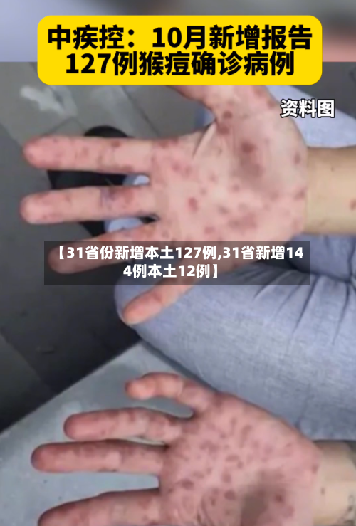 【31省份新增本土127例,31省新增144例本土12例】