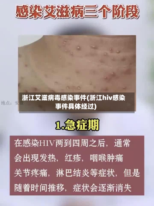 浙江艾滋病毒感染事件(浙江hiv感染事件具体经过)